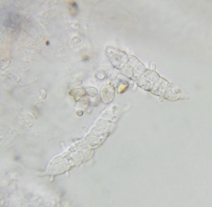macrostoma