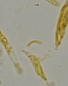 macrostoma