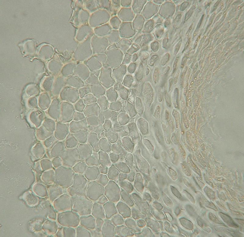 macrostoma