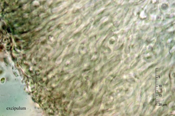 macrostoma