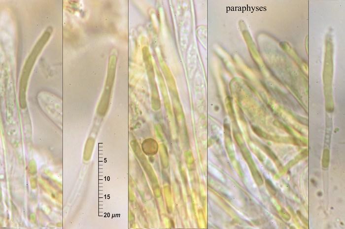macrostoma