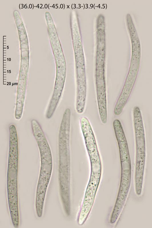 macrostoma