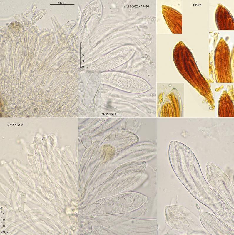 macrostoma