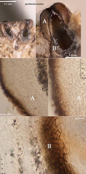 macrostoma