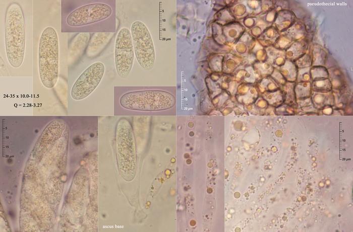 macrostoma