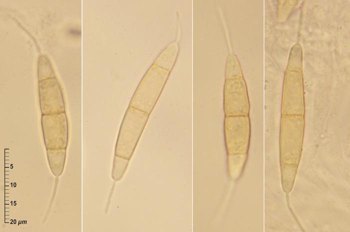 macrostoma