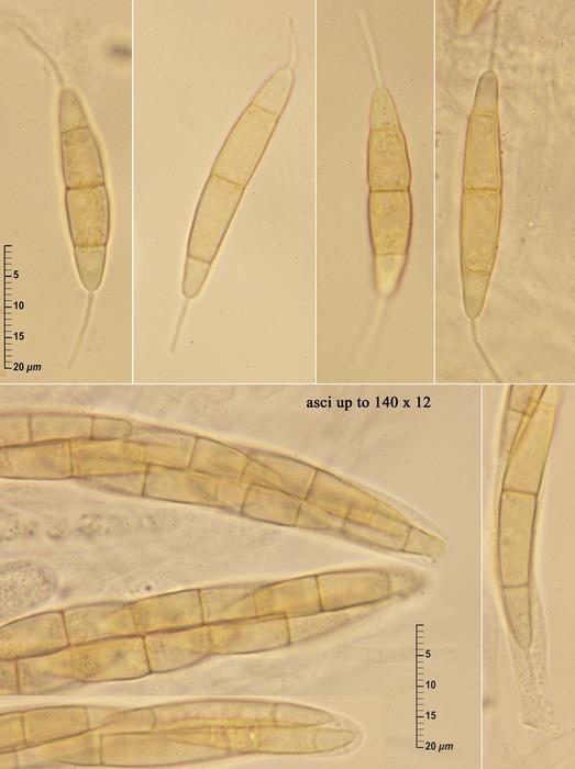 macrostoma
