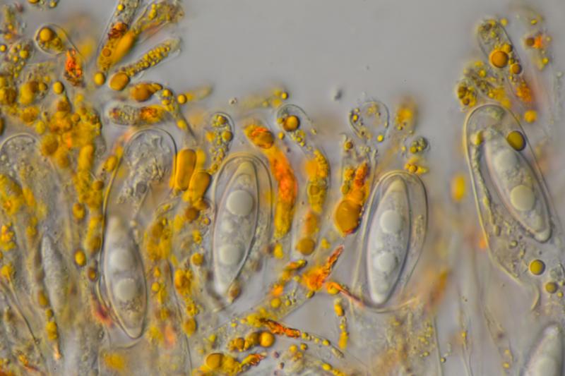 macrostoma
