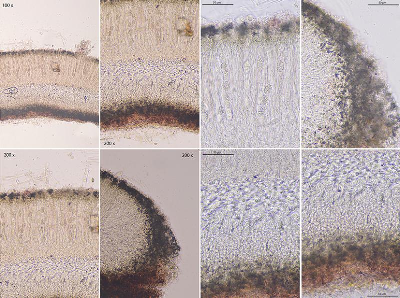 macrostoma