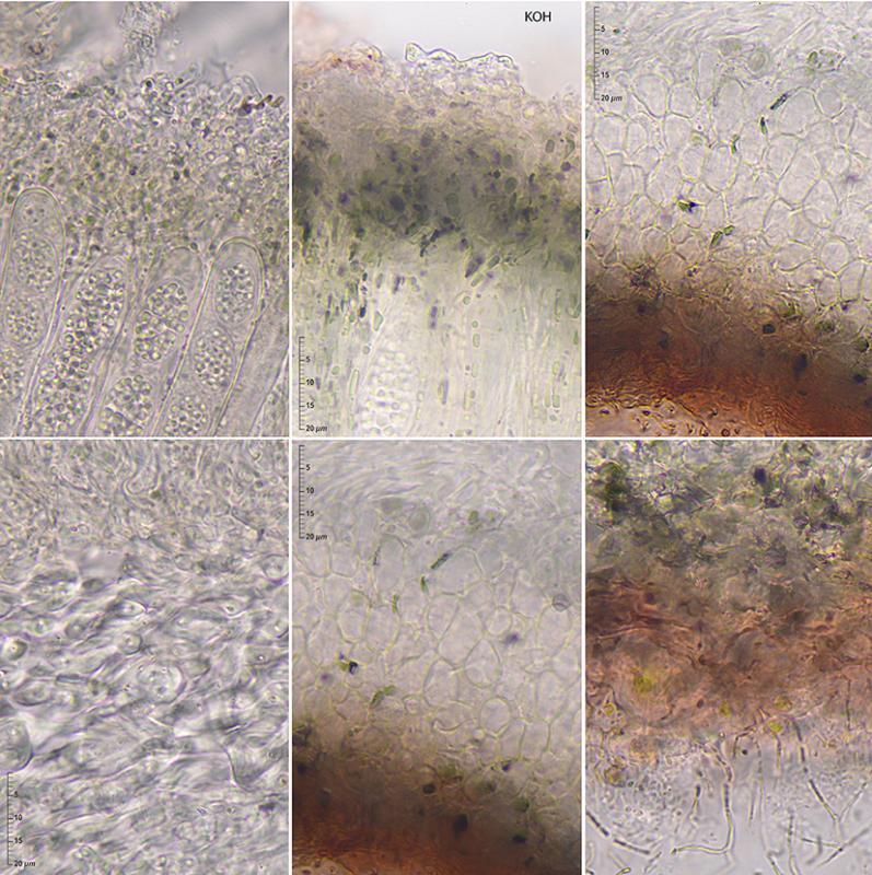 macrostoma