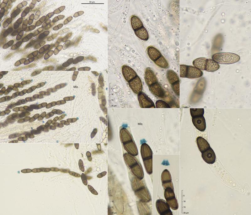 macrostoma
