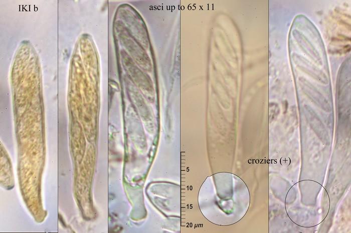 macrostoma
