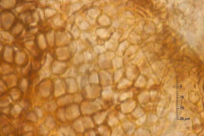 macrostoma