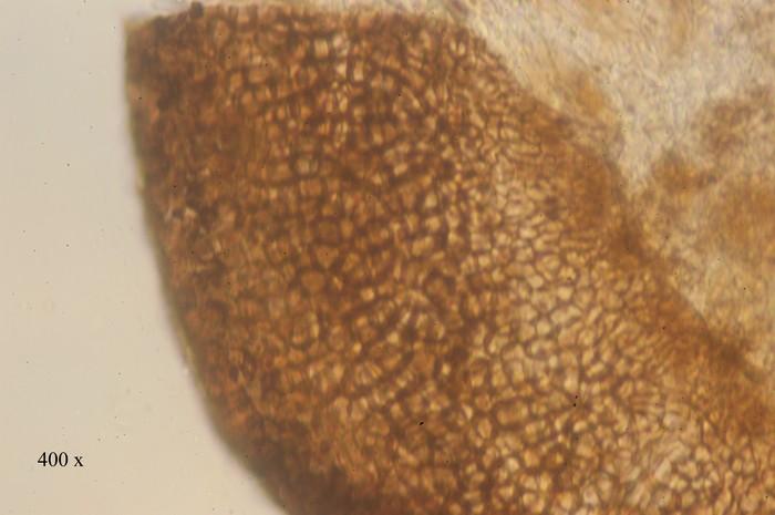 macrostoma