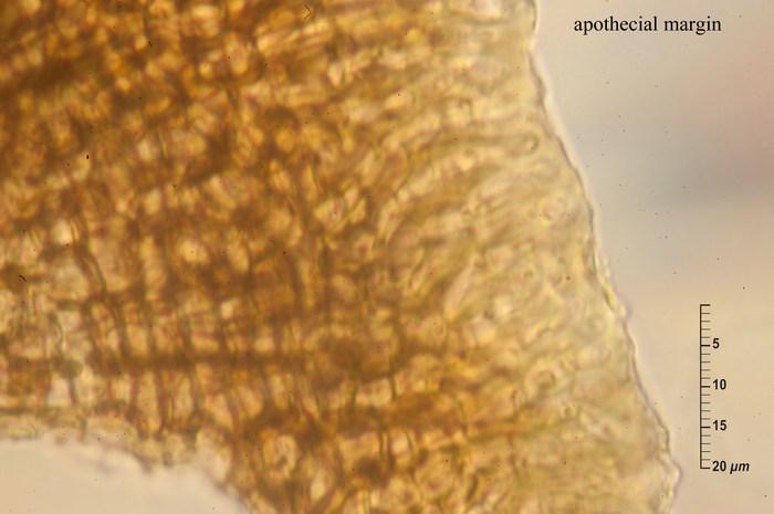 macrostoma