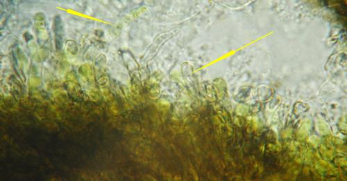macrostoma