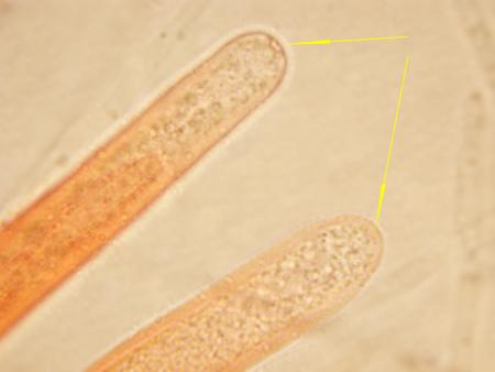 macrostoma