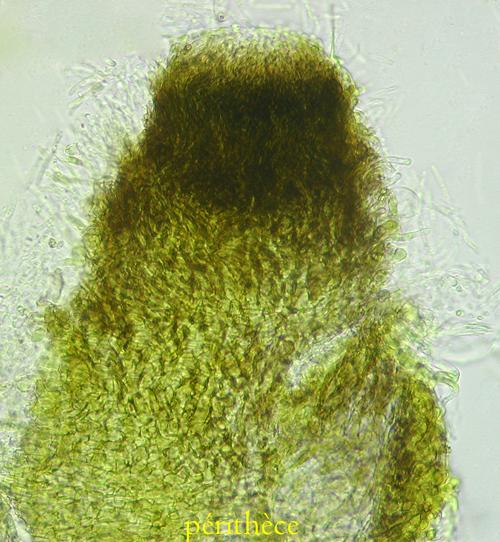 macrostoma
