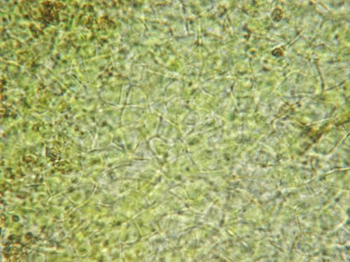 macrostoma
