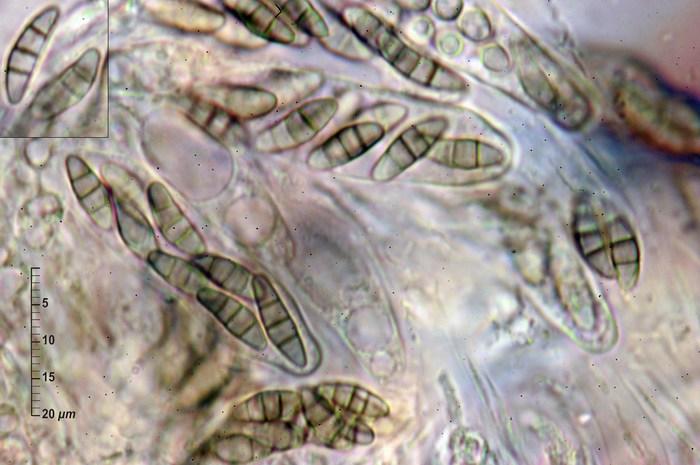 macrostoma