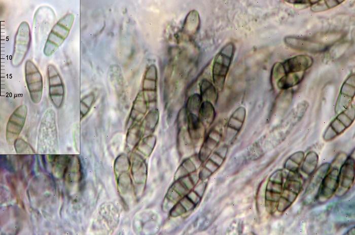 macrostoma