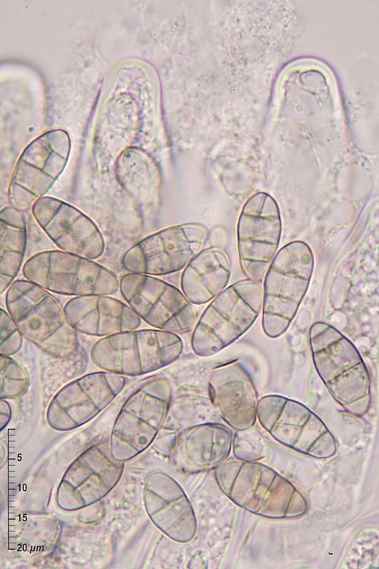 macrostoma