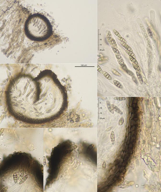 macrostoma