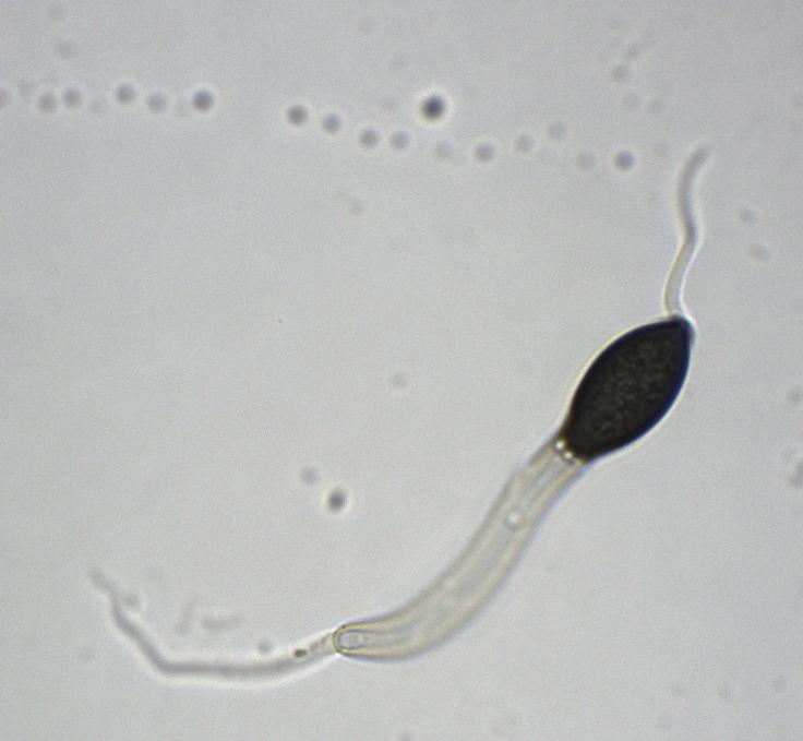 macrostoma