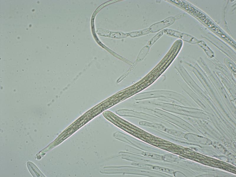 macrostoma