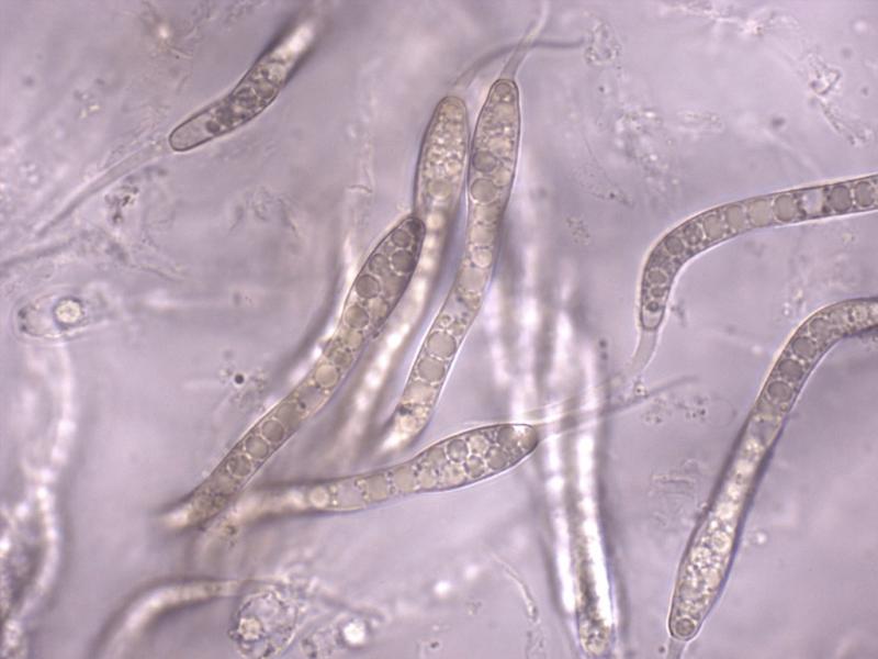 macrostoma