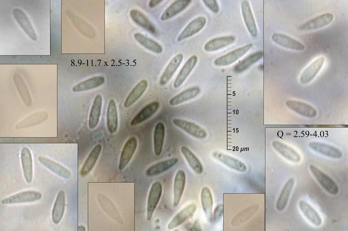 macrostoma