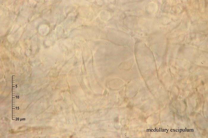 macrostoma