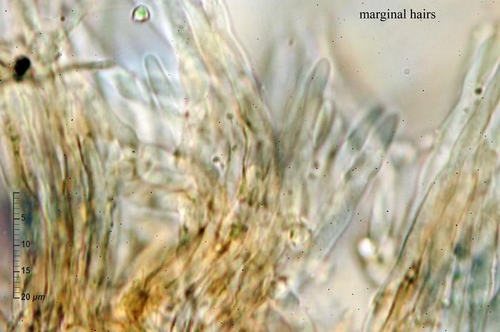 macrostoma