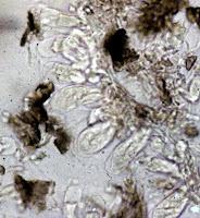 macrostoma