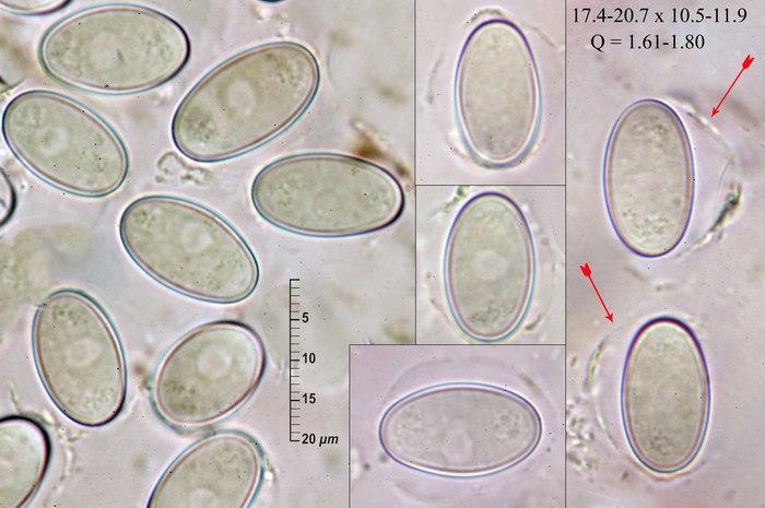 macrostoma