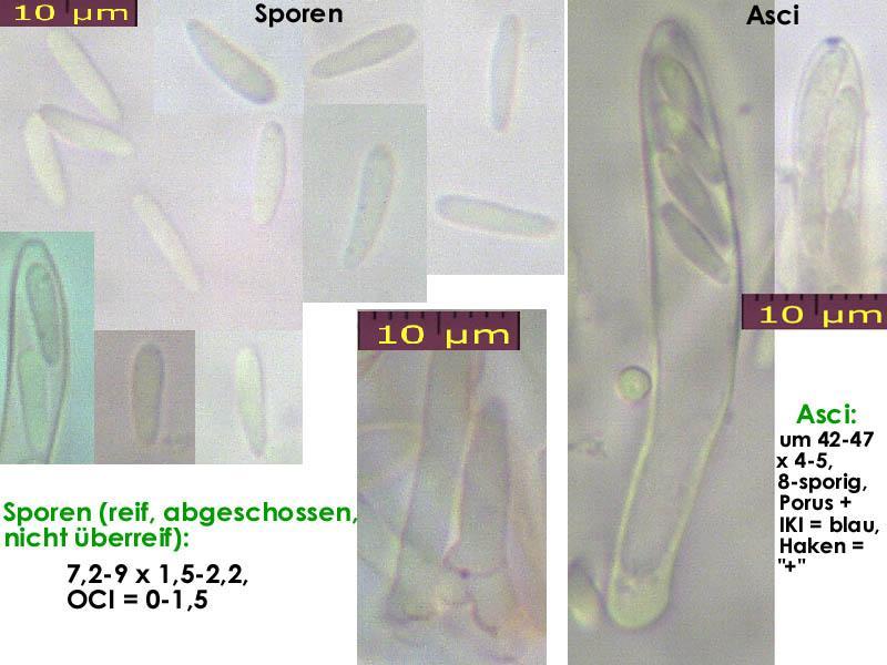 macrostoma