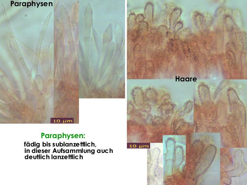 macrostoma