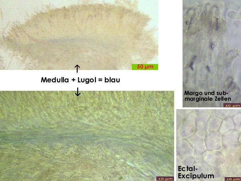 macrostoma