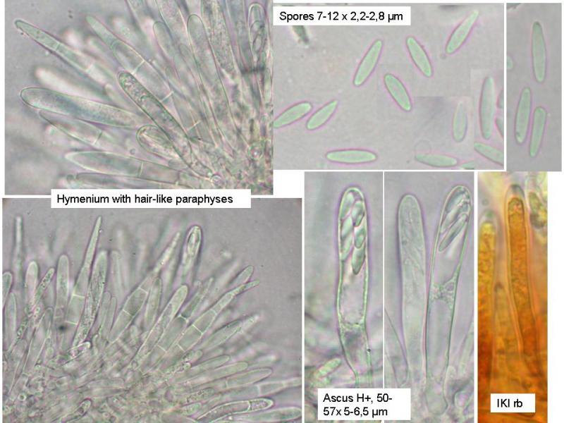 macrostoma