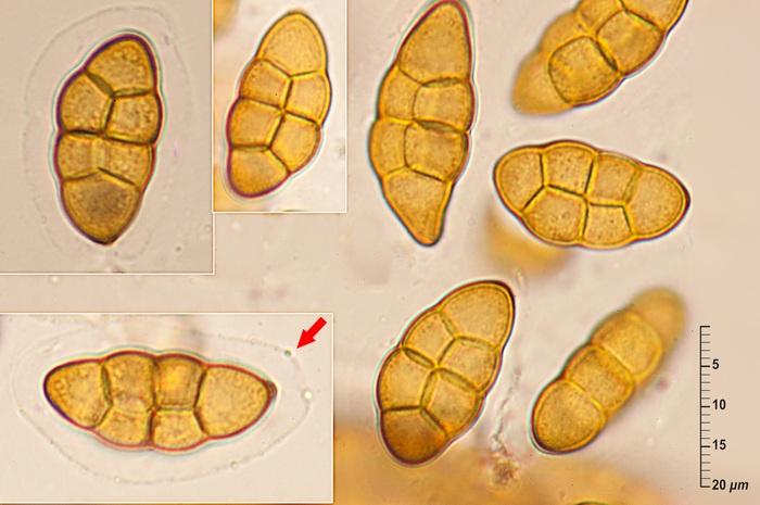 macrostoma