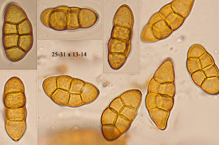 macrostoma