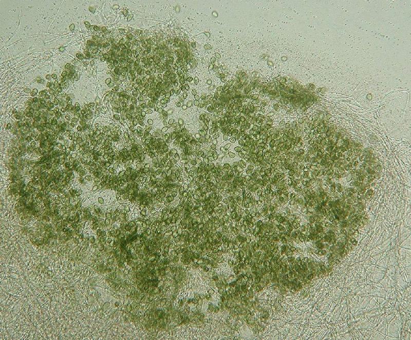 macrostoma