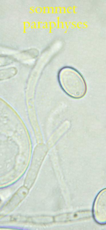 macrostoma