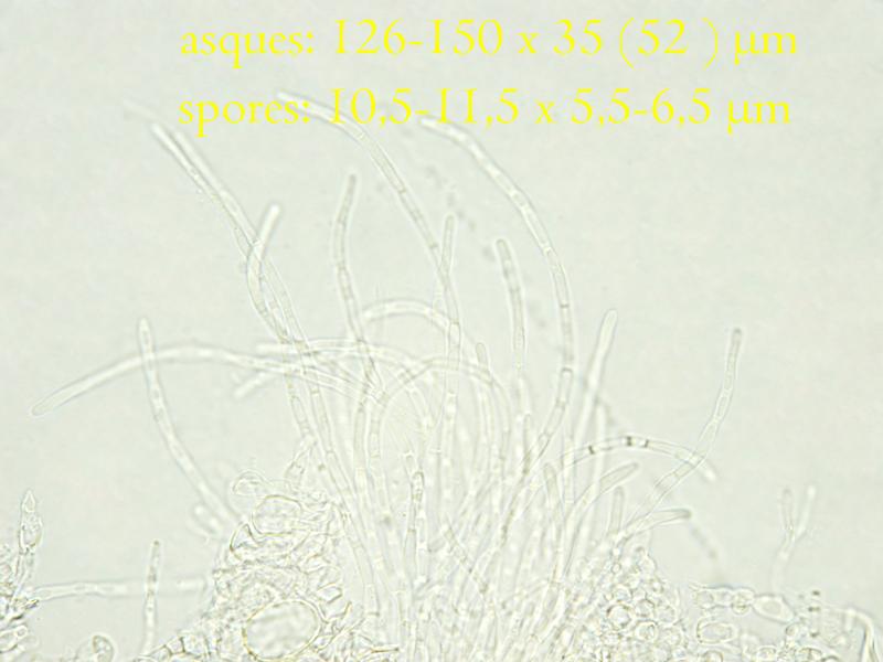 macrostoma