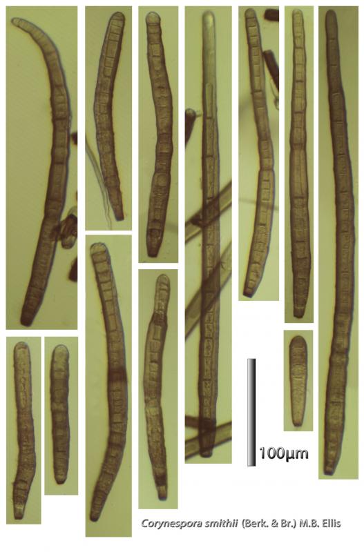 macrostoma