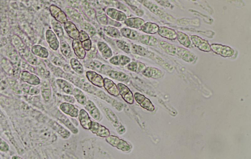 macrostoma