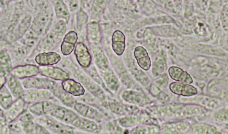 macrostoma