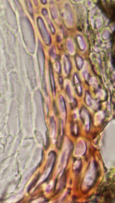 macrostoma