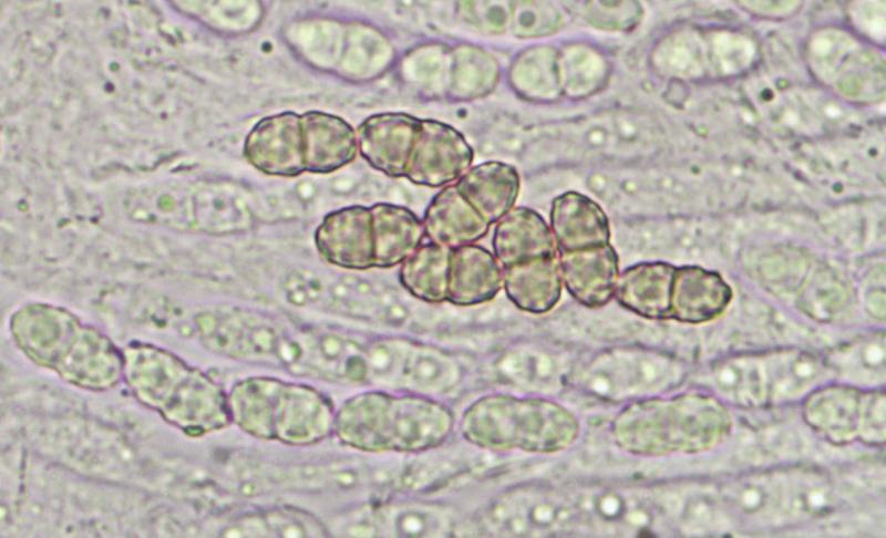macrostoma