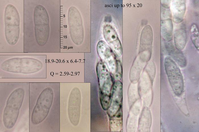 macrostoma
